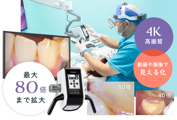 最大80倍まで拡大 4K高画質 動画や画像で見える化