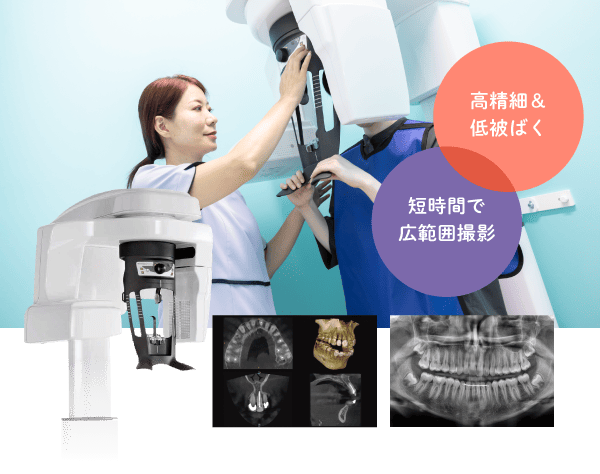 高精細&低被ばく 短時間で広範囲撮影