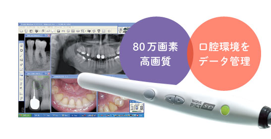 80万画素高画質 口腔環境をデータ管理