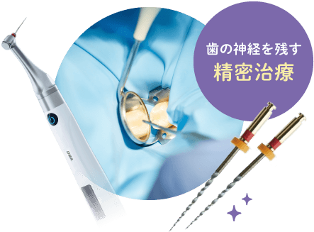 歯の神経を残す精密治療