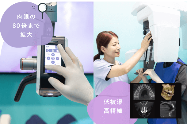 肉眼の80倍まで拡大 低被曝・高精細