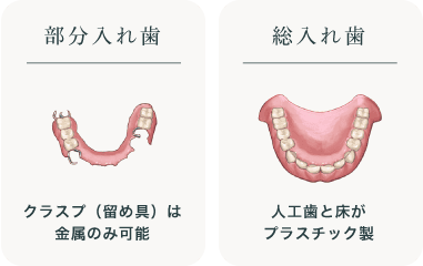 部分入れ歯(留め具は金属のみ使用)総入れ歯(人工歯と床がプラスチック製)