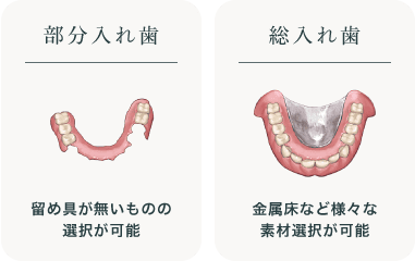 部分入れ歯(留め具が無いものの選択が可能)総入れ歯(金属床など様々な素材選択が可能)