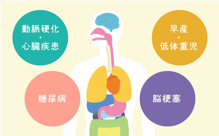 動脈硬化・心臓疾患・早産・低体重児・糖尿病・脳梗塞