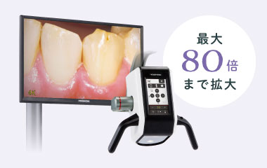 最大80倍まで拡大