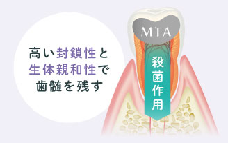 高い封鎖性と生体親和性で歯髄を残す