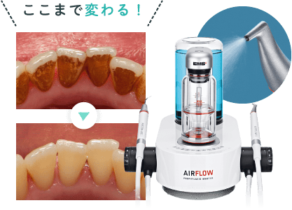 ここまで変わる